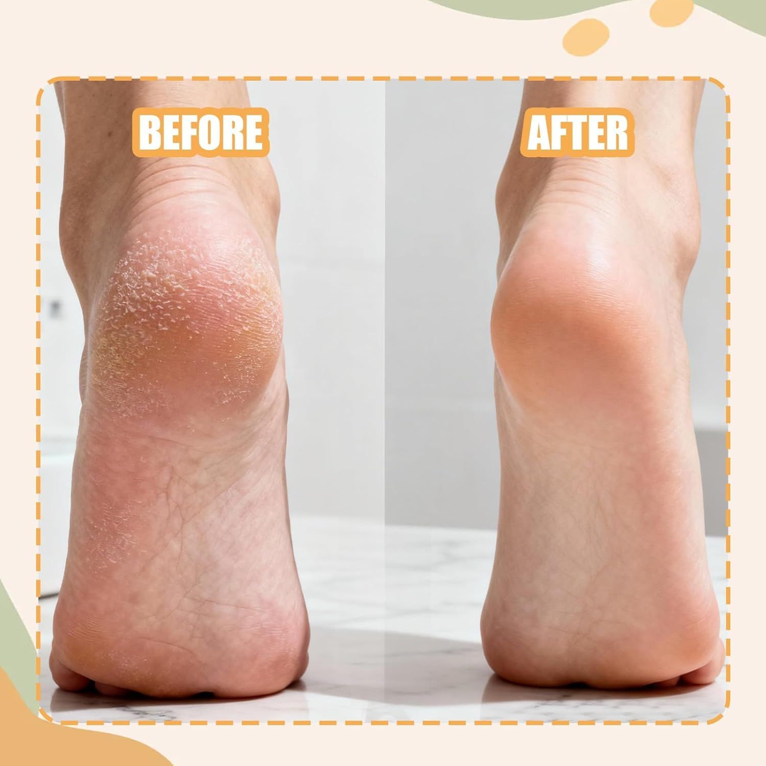 3PCS Precision Callus Remover & Bunion Scrubber for Toe Gaps